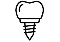 ایمپلنت دیجیتال در کرج